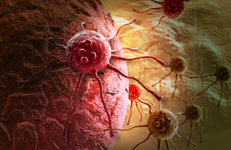 Le cancer : définition, traitements et effets