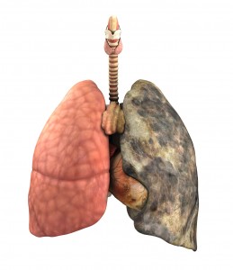 Lung Disease Before and After