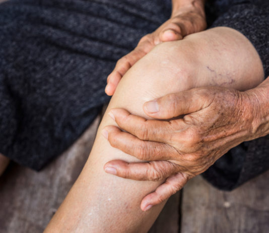 Pour stopper la spirale infernale de l’arthrose