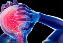 Accident Vasculaire Cérébral  : extrait 102 maladies du XXIe siècle