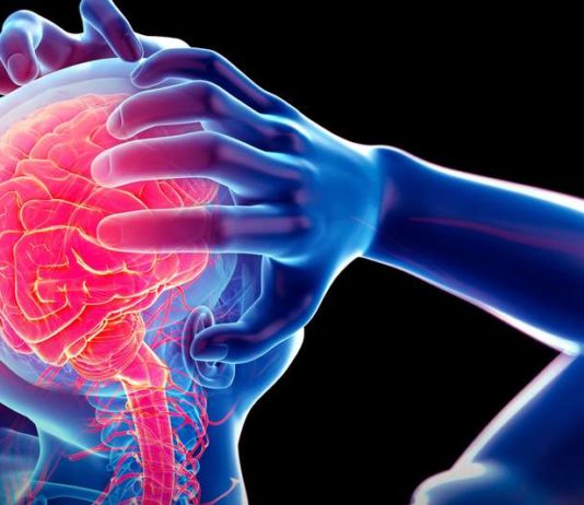 Accident Vasculaire Cérébral : extrait 102 maladies du XXIe siècle